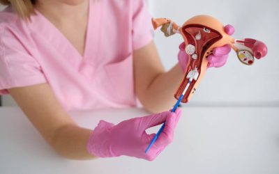 ¿Qué es la endometriosis y cuáles son los síntomas?