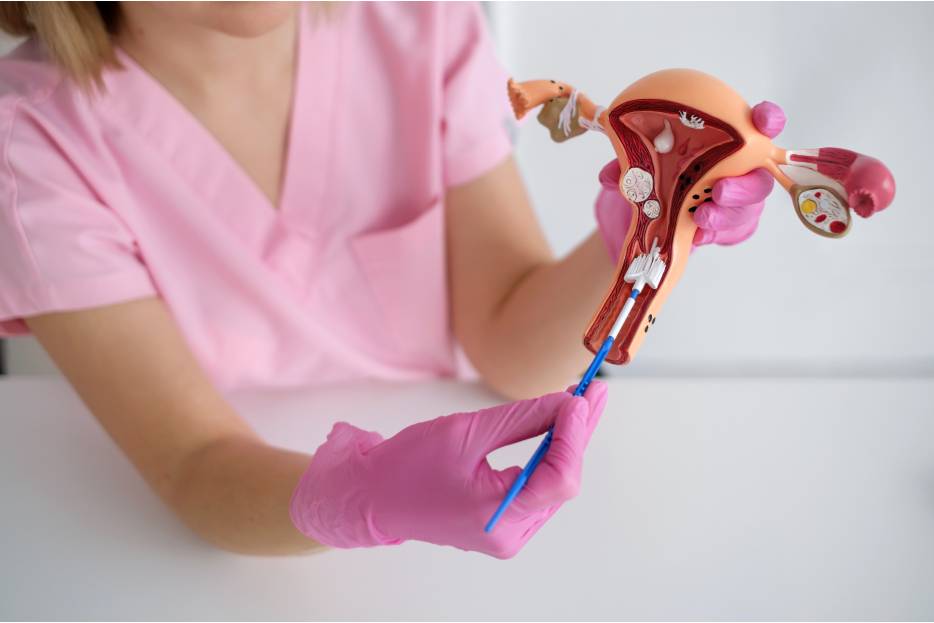 ¿Qué es la endometriosis y cuáles son los síntomas?