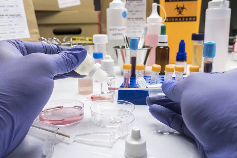 Importancia de los exámenes de laboratorio preventivos