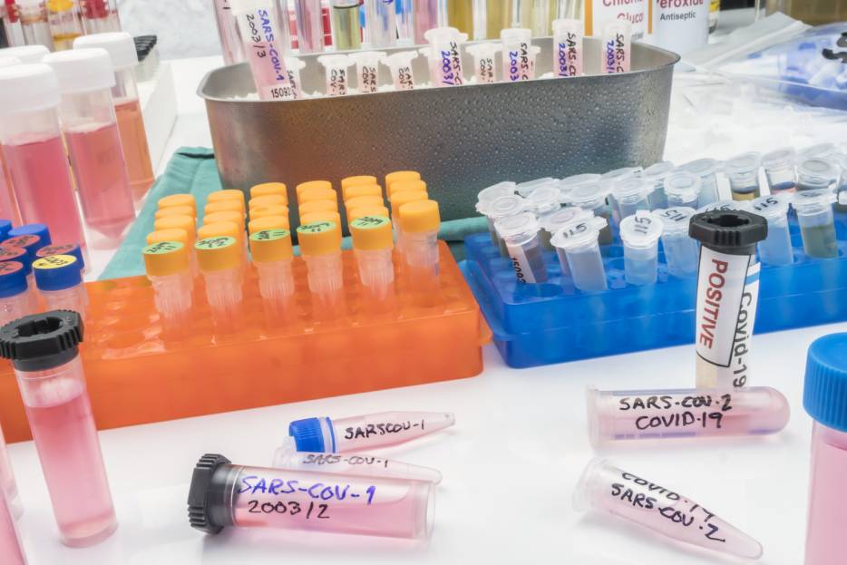 pruebas de laboratorio preventivas