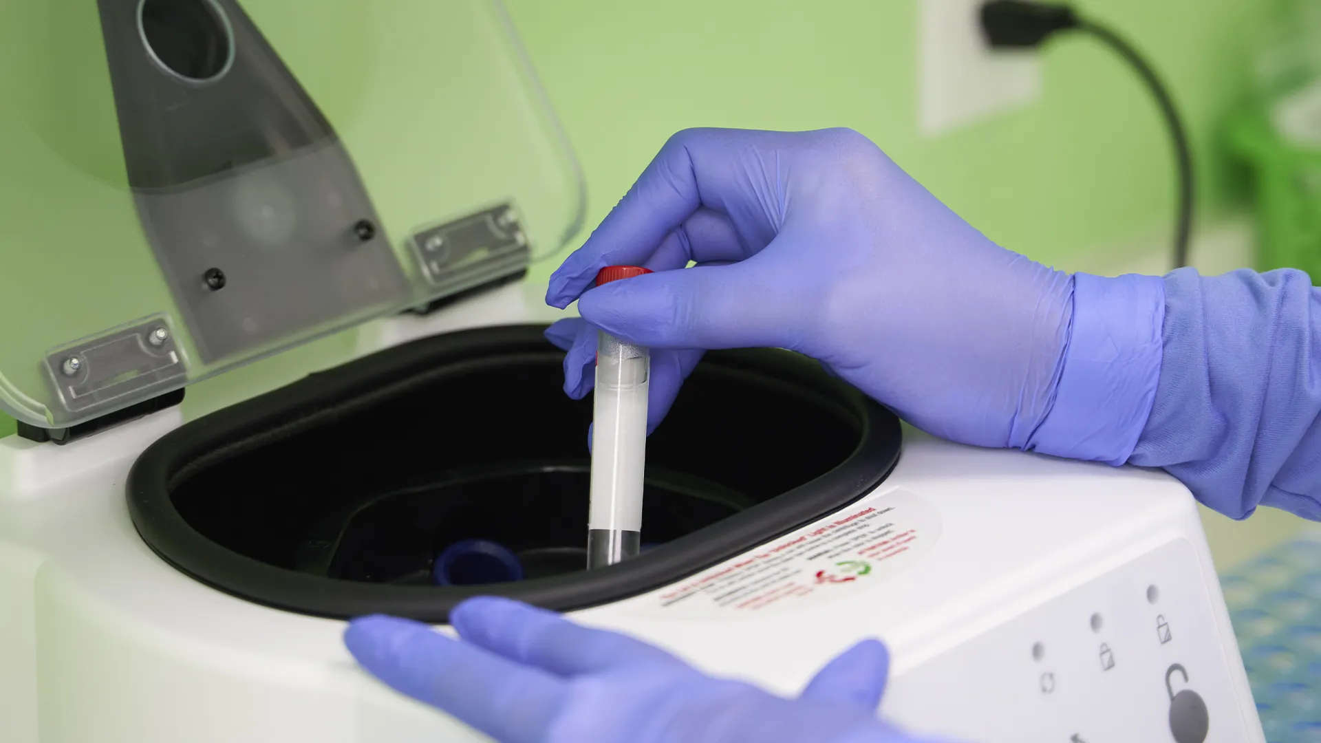 Técnico de laboratorio procesando muestra para análisis clínico en Clínica la Virgen de Guadalupe