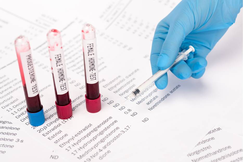 Controlar los niveles con pruebas hormonales es clave para diagnosticar y tratar condiciones que impactan la salud general.
